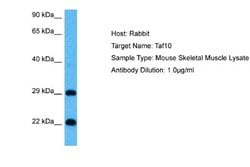 TAF10 Rabbit anti-Human, Mouse, Polyclonal, Novus Biologicals 0.1 mL | Buy Online | Novus Biologicals | Fisher Scientific